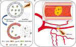 Photothermal-Activatable Liposome Carrying Tissue Plasminogen Activator for Photoacoustic Image-Guided Ischemic Stroke Treatment